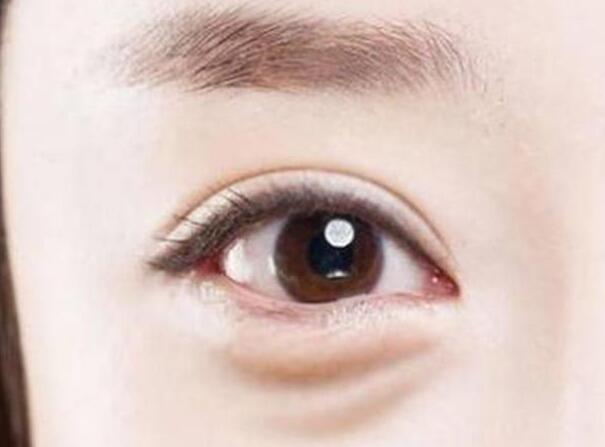 眼袋？淚溝？臥蠶？南寧美容學校教你辨別