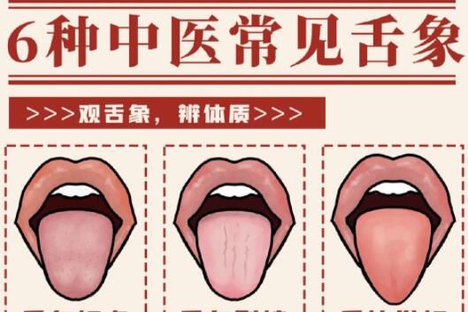 6種常見中醫(yī)舌診判定，快和廣西中醫(yī)美容一起學
