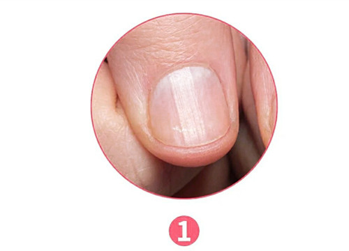 女生氣血不足六大表現(xiàn)，南寧美容養(yǎng)生資訊報道