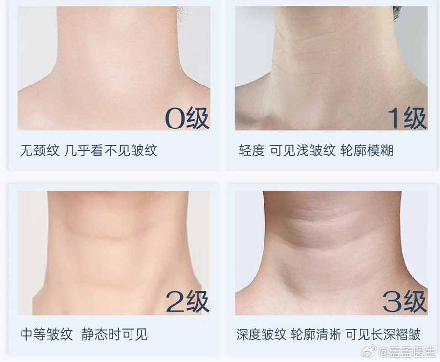 如何緩解頸紋？南寧美體美容管理培訓(xùn)